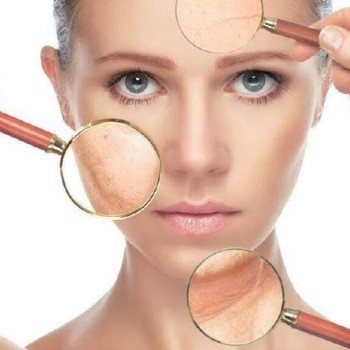 Nara crema  activa antimanchas