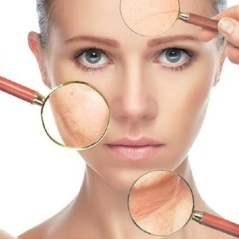 Nara crema  activa antimanchas